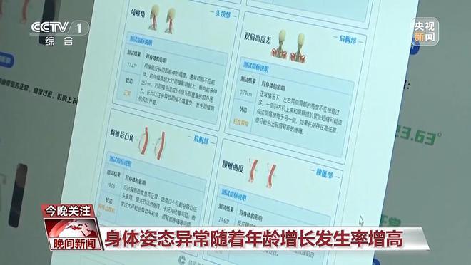 脊柱侧弯、高低肩怎么办？四要素助你保护脊柱健康(图3)