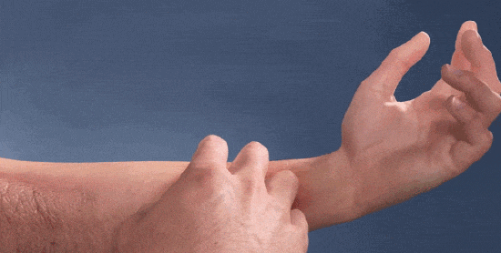 湿疹体质有救了!这款没有激素的湿疹膏安全高效断痒无激素不刺激一抹见效告别反复！(图2)