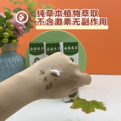湿疹体质有救了!这款没有激素的湿疹膏安全高效断痒无激素不刺激一抹见效告别反复！(图7)